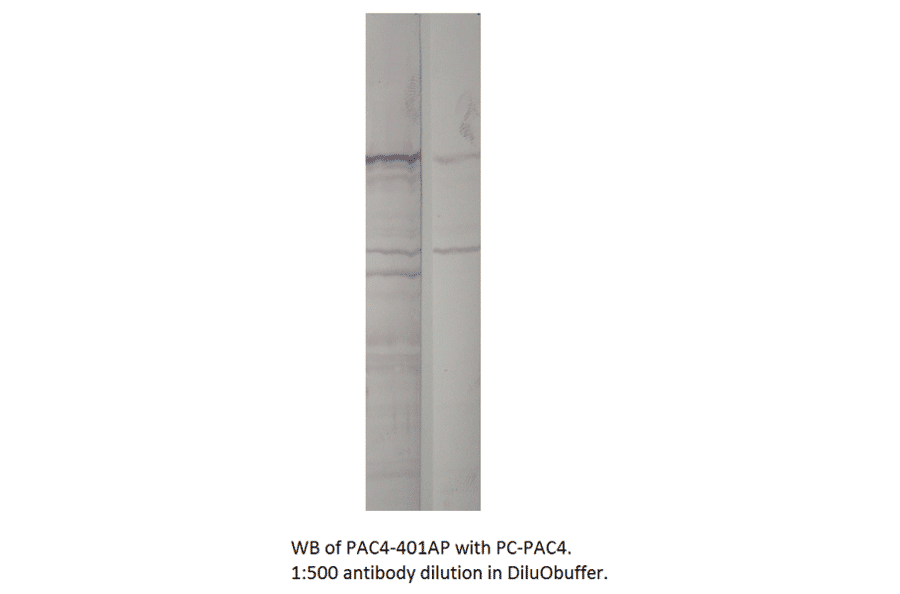 Anti-ADCY4 Antibody from FabGennix (PAC-401AP) - Antibodies.com