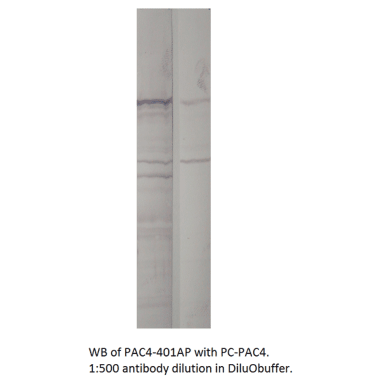 Anti-ADCY4 Antibody from FabGennix (PAC-401AP) - Antibodies.com