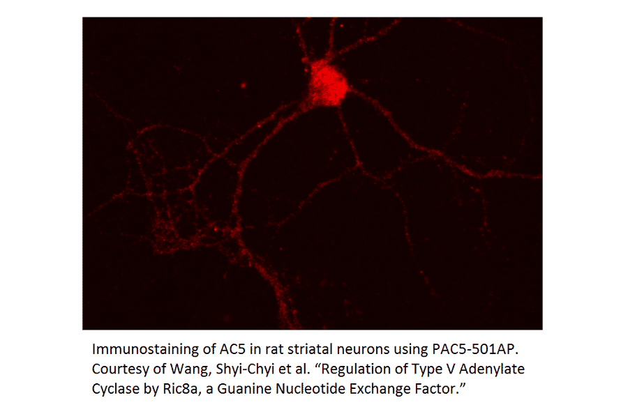 Anti-ADCY5 Antibody from FabGennix (PAC-501AP) - Antibodies.com