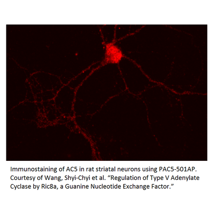 Anti-ADCY5 Antibody from FabGennix (PAC-501AP) - Antibodies.com