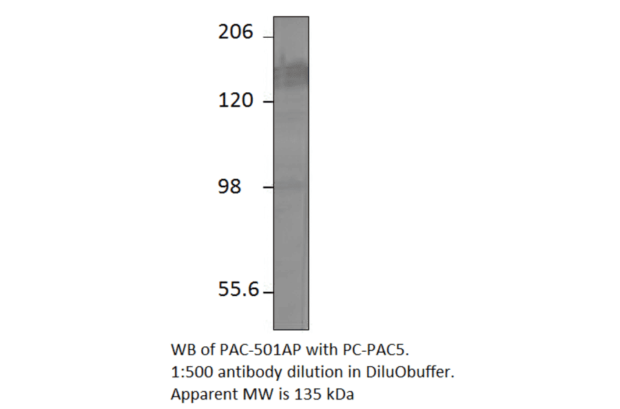 Anti-ADCY5 Antibody from FabGennix (PAC-501AP) - Antibodies.com
