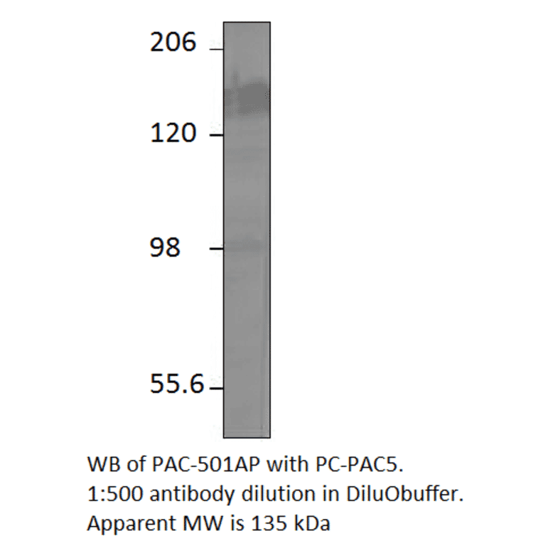 Anti-ADCY5 Antibody from FabGennix (PAC-501AP) - Antibodies.com