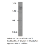 Anti-ADCY5 Antibody from FabGennix (PAC-501AP) - Antibodies.com