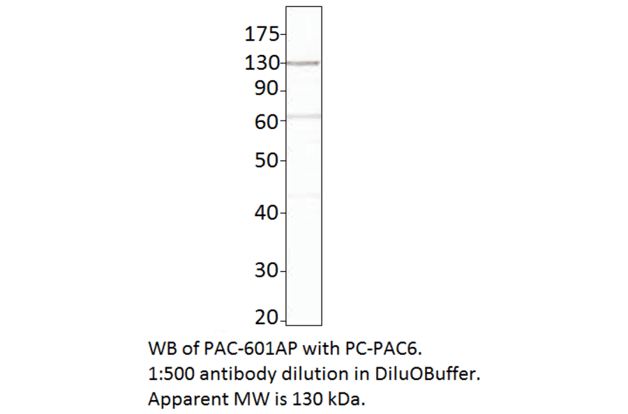 Anti-ADCY6 Antibody from FabGennix (PAC-601AP) - Antibodies.com
