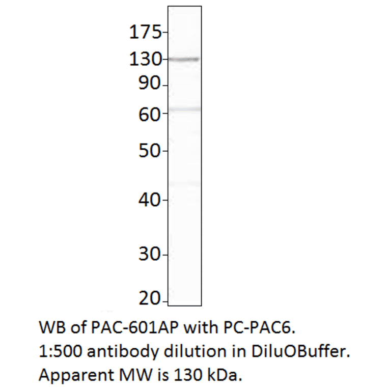 Anti-ADCY6 Antibody from FabGennix (PAC-601AP) - Antibodies.com