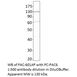 Anti-ADCY6 Antibody from FabGennix (PAC-601AP) - Antibodies.com
