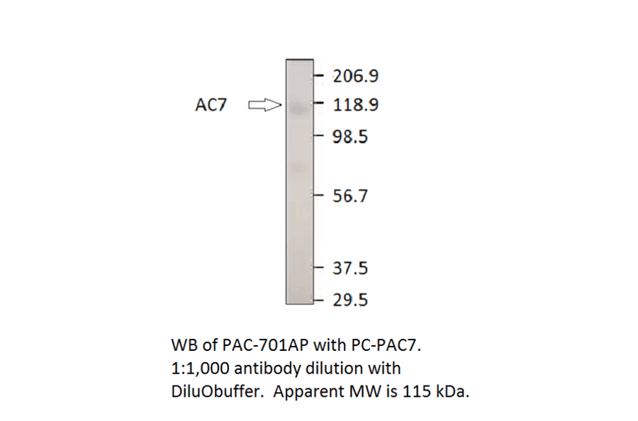 Anti-ADCY7 Antibody from FabGennix (PAC-701AP) - Antibodies.com