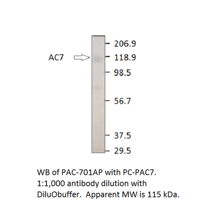 Anti-ADCY7 Antibody from FabGennix (PAC-701AP) - Antibodies.com