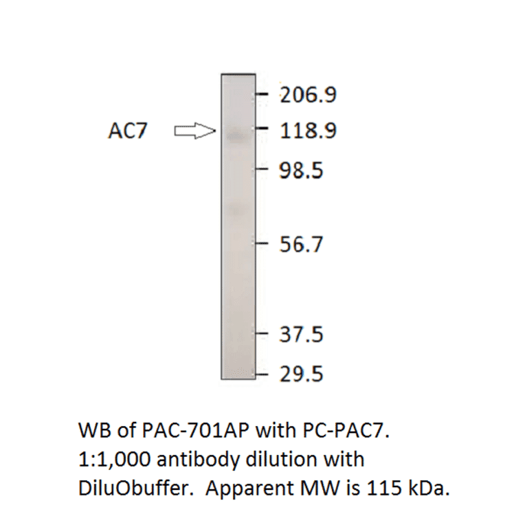 Anti-ADCY7 Antibody from FabGennix (PAC-701AP) - Antibodies.com