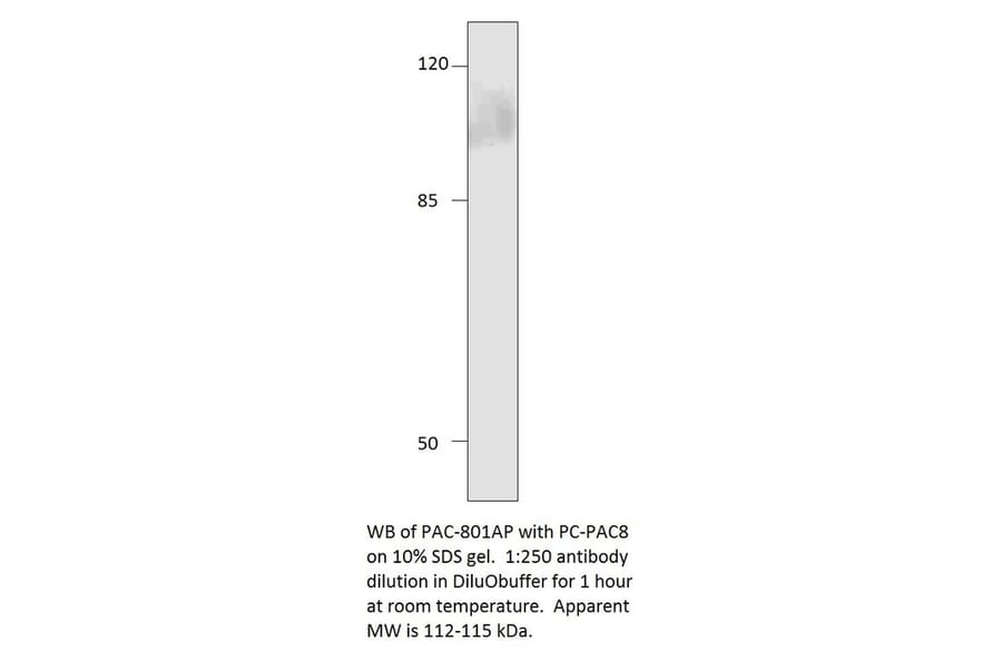 Anti-ADCY8 Antibody from FabGennix (PAC-801AP) - Antibodies.com