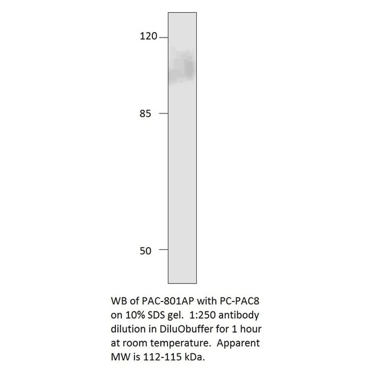 Anti-ADCY8 Antibody from FabGennix (PAC-801AP) - Antibodies.com