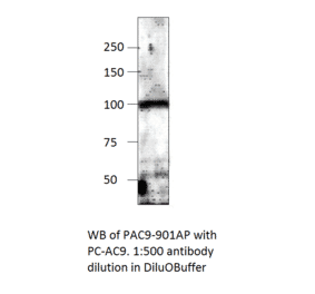 Anti-ADCY9 Antibody from FabGennix (PAC-901AP) - Antibodies.com