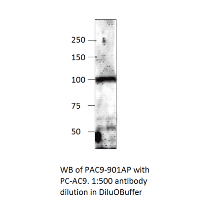 Anti-ADCY9 Antibody from FabGennix (PAC-901AP) - Antibodies.com