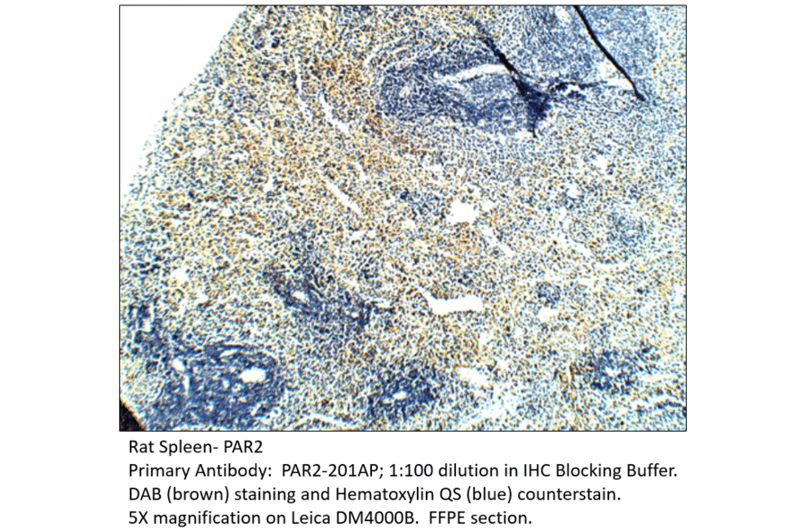 Anti-PAR2 Antibody from FabGennix (PAR2-201AP) - Antibodies.com