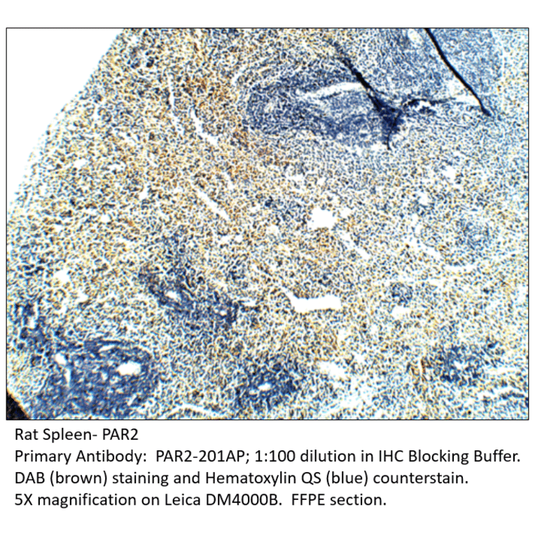 Anti-PAR2 Antibody from FabGennix (PAR2-201AP) - Antibodies.com