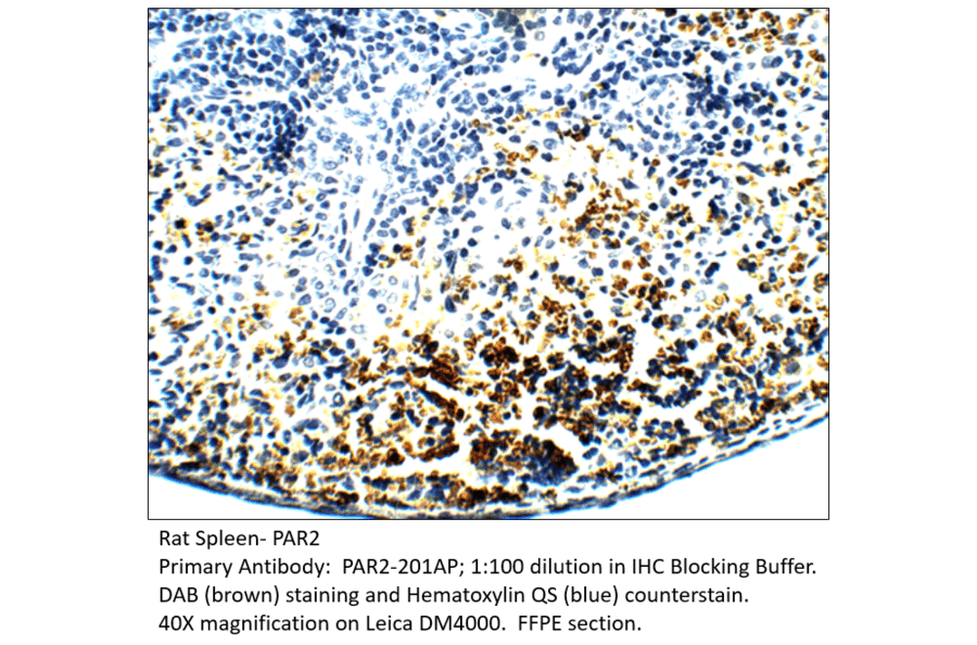 Anti-PAR2 Antibody from FabGennix (PAR2-201AP) - Antibodies.com
