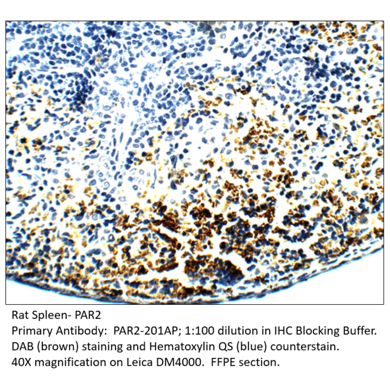 Anti-PAR2 Antibody from FabGennix (PAR2-201AP) - Antibodies.com
