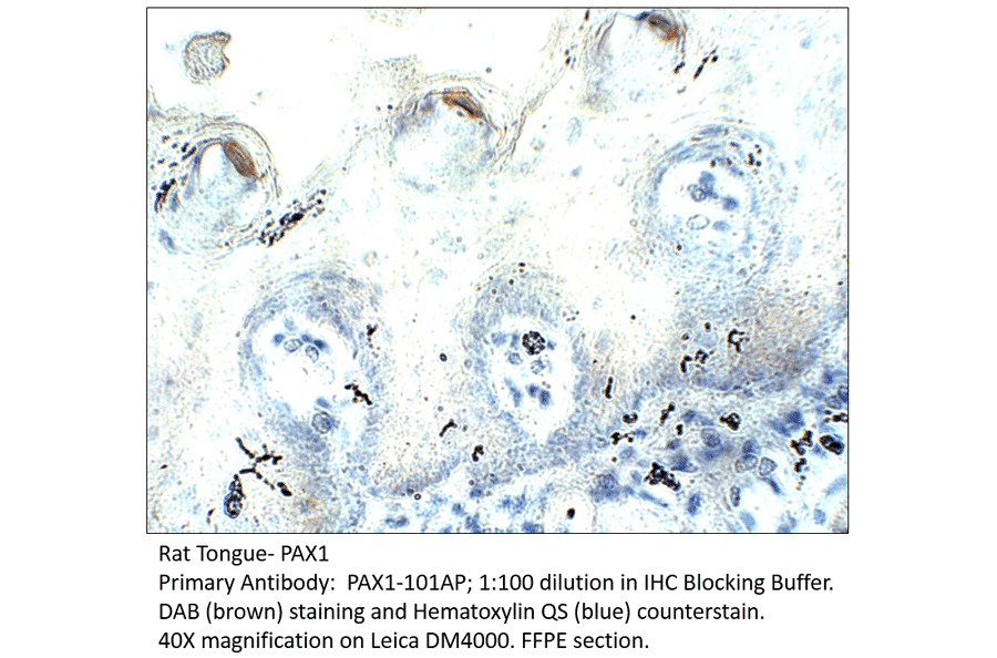Anti-PAX1 Antibody from FabGennix (PAX1-101AP) - Antibodies.com
