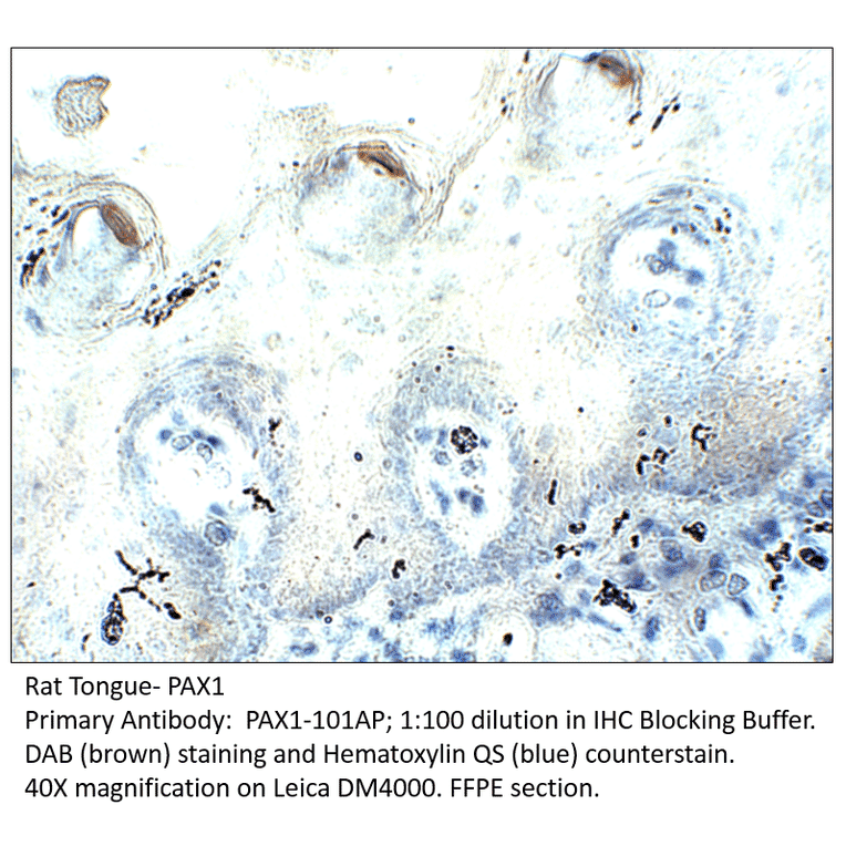 Anti-PAX1 Antibody from FabGennix (PAX1-101AP) - Antibodies.com