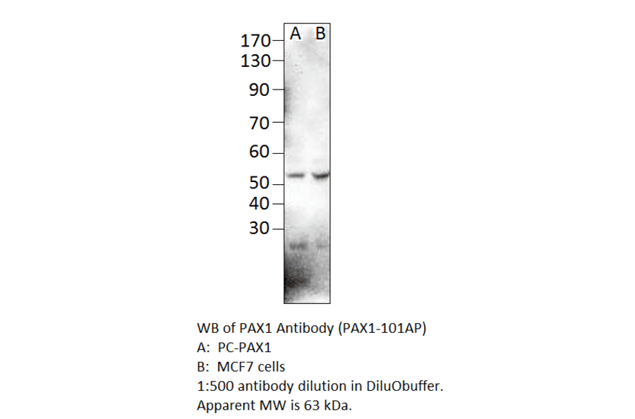 Anti-PAX1 Antibody from FabGennix (PAX1-101AP) - Antibodies.com