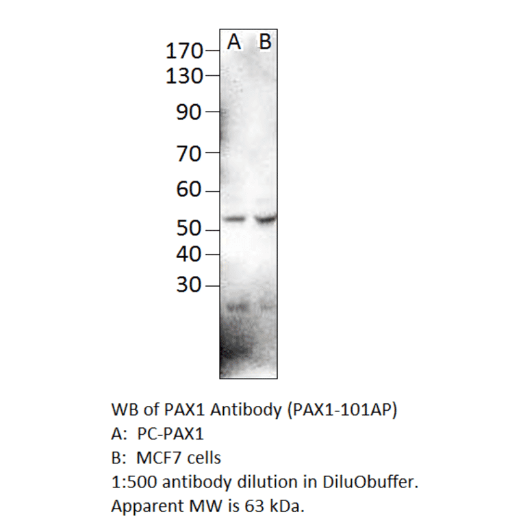Anti-PAX1 Antibody from FabGennix (PAX1-101AP) - Antibodies.com