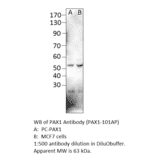 Anti-PAX1 Antibody from FabGennix (PAX1-101AP) - Antibodies.com