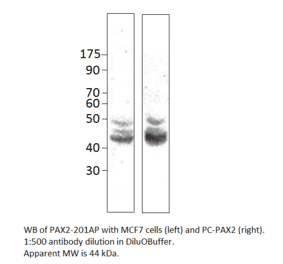 Anti-Pax2 Antibody from FabGennix (PAX2-201AP) - Antibodies.com