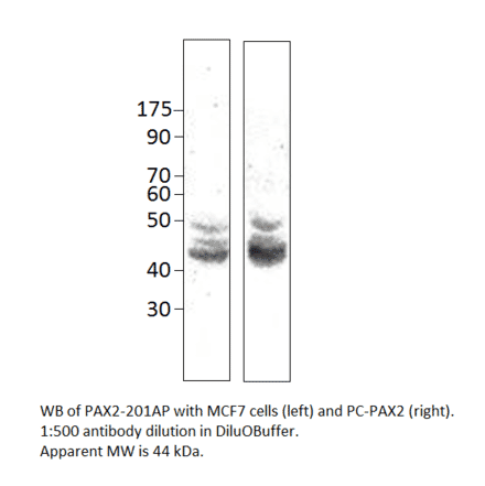 Anti-Pax2 Antibody from FabGennix (PAX2-201AP) - Antibodies.com
