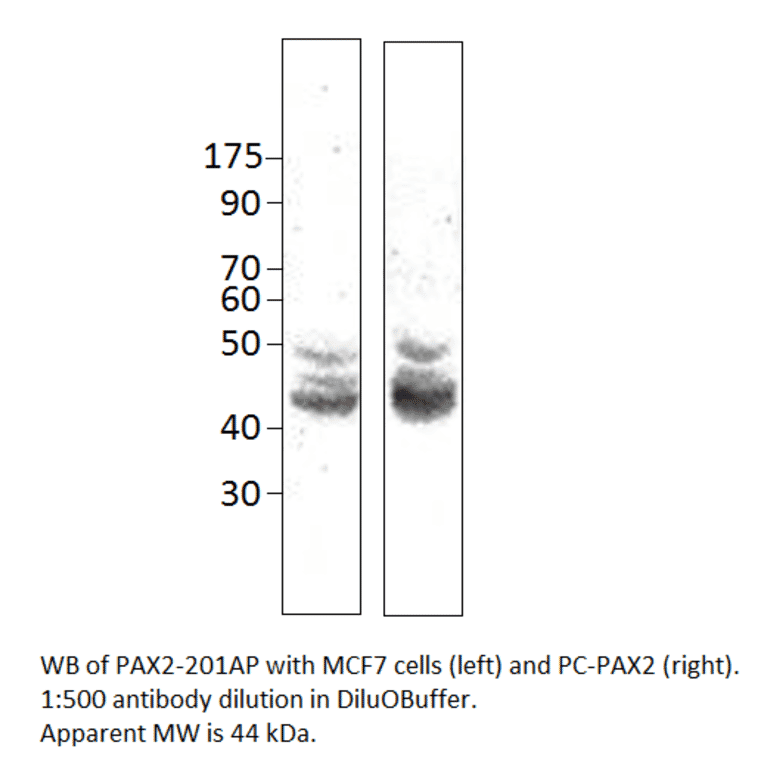 Anti-Pax2 Antibody from FabGennix (PAX2-201AP) - Antibodies.com