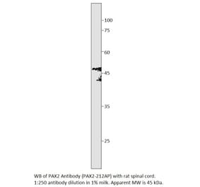 Anti-PAX2 Antibody from FabGennix (PAX2-212AP) - Antibodies.com