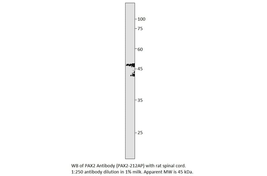 Anti-PAX2 Antibody from FabGennix (PAX2-212AP) - Antibodies.com