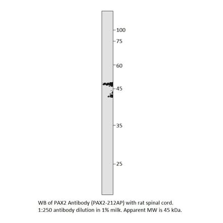 Anti-PAX2 Antibody from FabGennix (PAX2-212AP) - Antibodies.com