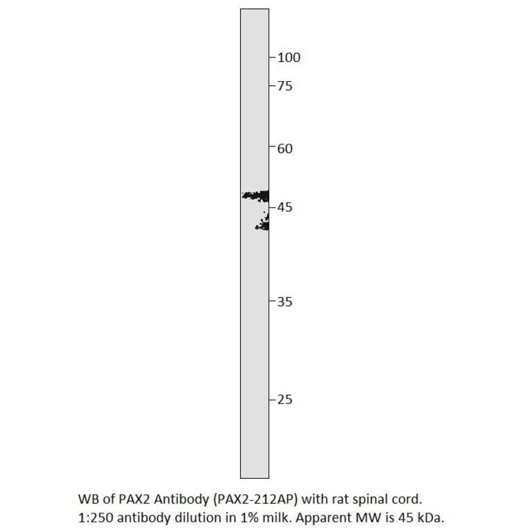 Anti-PAX2 Antibody from FabGennix (PAX2-212AP) - Antibodies.com