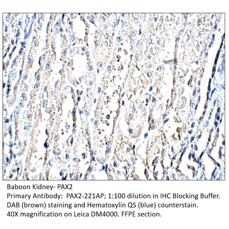 Anti-Pax2 Antibody from FabGennix (PAX2-221AP) - Antibodies.com