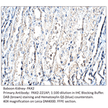 Anti-Pax2 Antibody from FabGennix (PAX2-221AP) - Antibodies.com