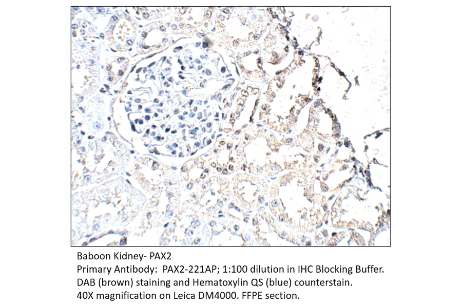 Anti-Pax2 Antibody from FabGennix (PAX2-221AP) - Antibodies.com
