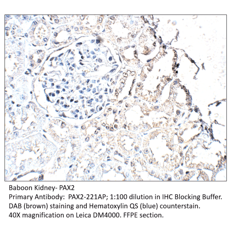 Anti-Pax2 Antibody from FabGennix (PAX2-221AP) - Antibodies.com