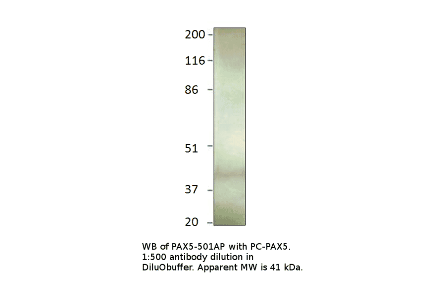 Anti-PAX5 Antibody from FabGennix (PAX5-501AP) - Antibodies.com
