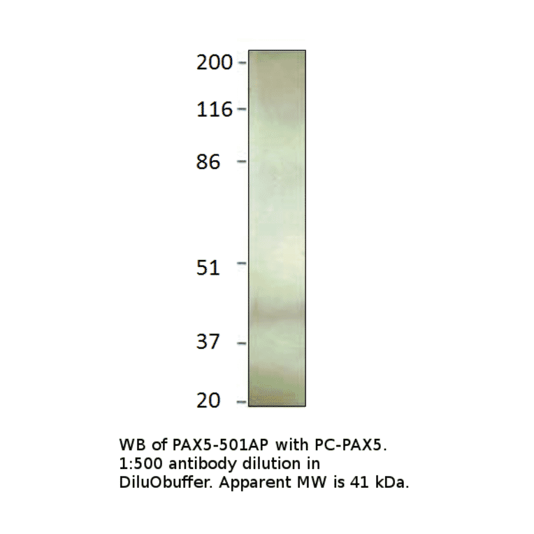 Anti-PAX5 Antibody from FabGennix (PAX5-501AP) - Antibodies.com