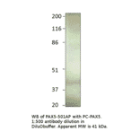 Anti-PAX5 Antibody from FabGennix (PAX5-501AP) - Antibodies.com