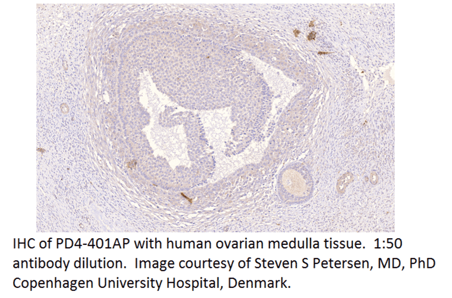 Anti-PDE4D Antibody from FabGennix (PD4-401AP) - Antibodies.com