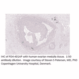 Anti-PDE4D Antibody from FabGennix (PD4-401AP) - Antibodies.com