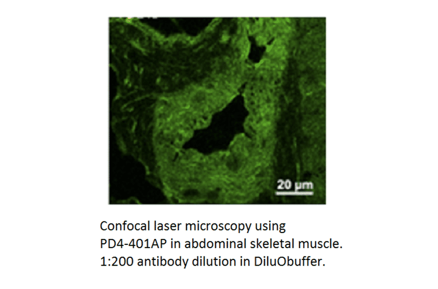 Anti-PDE4D Antibody from FabGennix (PD4-401AP) - Antibodies.com