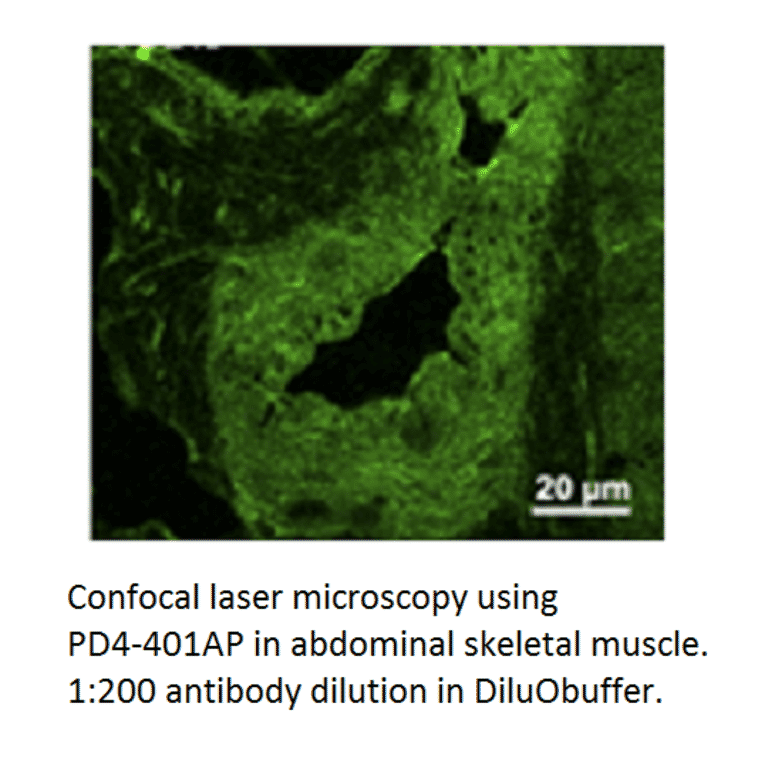 Anti-PDE4D Antibody from FabGennix (PD4-401AP) - Antibodies.com