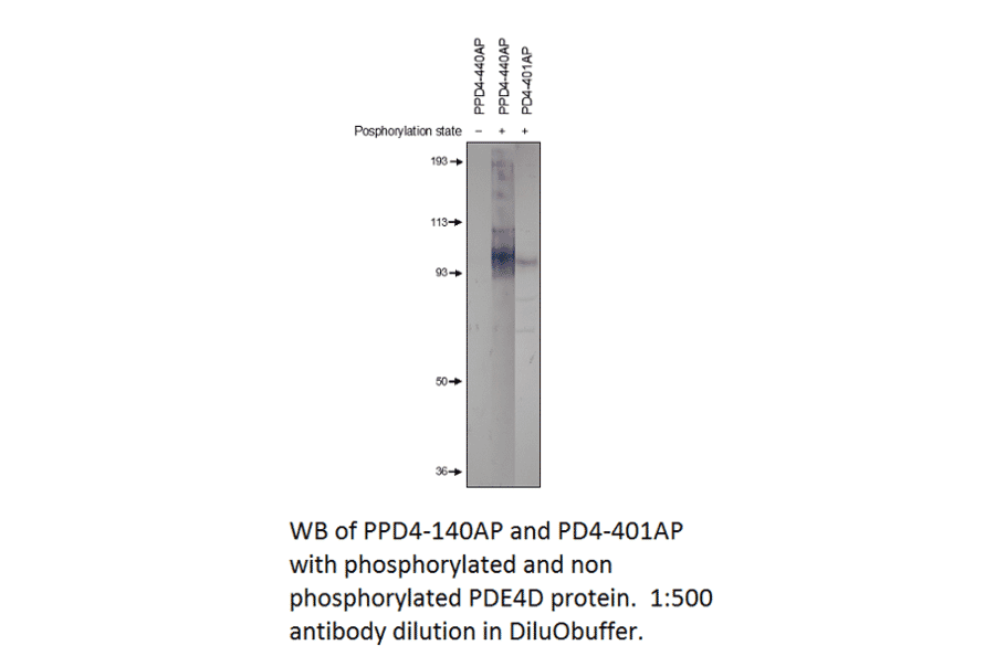 Anti-PDE4D Antibody from FabGennix (PD4-401AP) - Antibodies.com