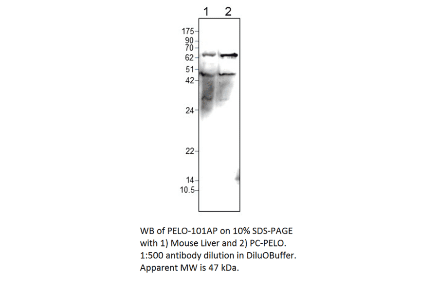 Anti-PELO Antibody from FabGennix (PELO-101AP) - Antibodies.com