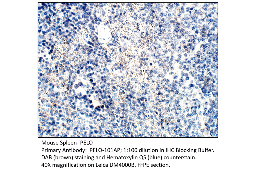 Anti-PELO Antibody from FabGennix (PELO-101AP) - Antibodies.com