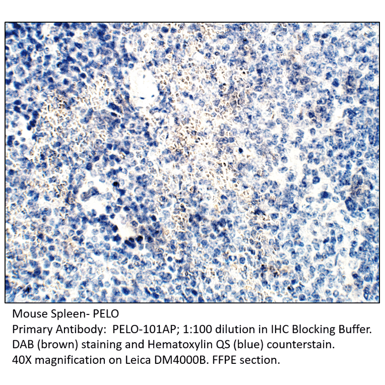 Anti-PELO Antibody from FabGennix (PELO-101AP) - Antibodies.com