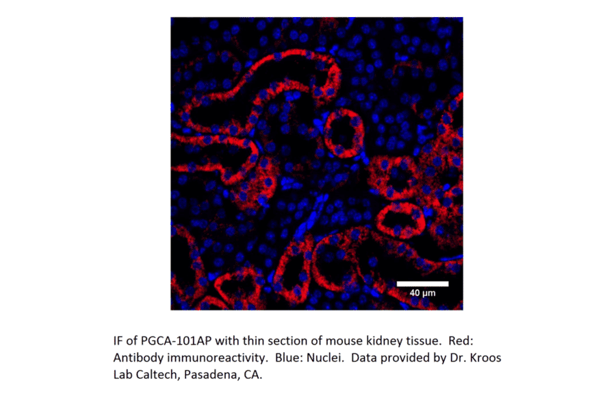 Anti-PGCA Antibody from FabGennix (PGCA-101AP) - Antibodies.com