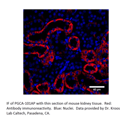 Anti-PGCA Antibody from FabGennix (PGCA-101AP) - Antibodies.com